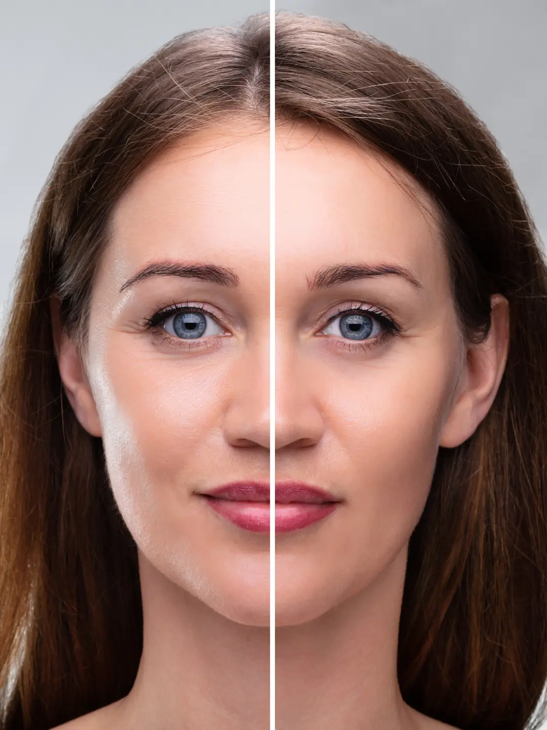 Tratamento facial da mulher: antes e depois.