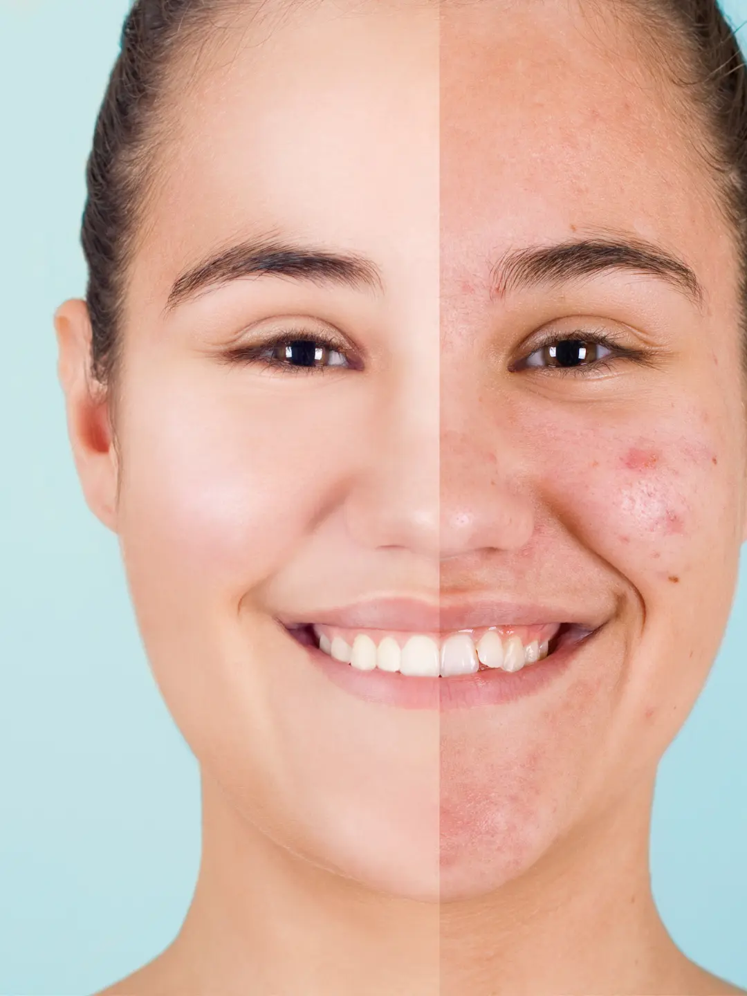 Tratamento facial da mulher: antes e depois.