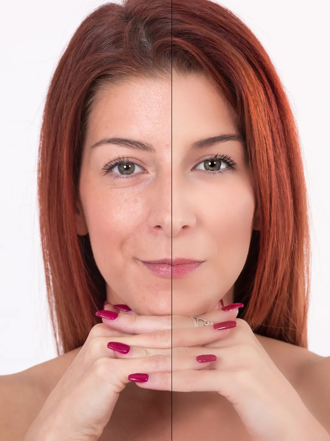 Tratamento facial da mulher: antes e depois.