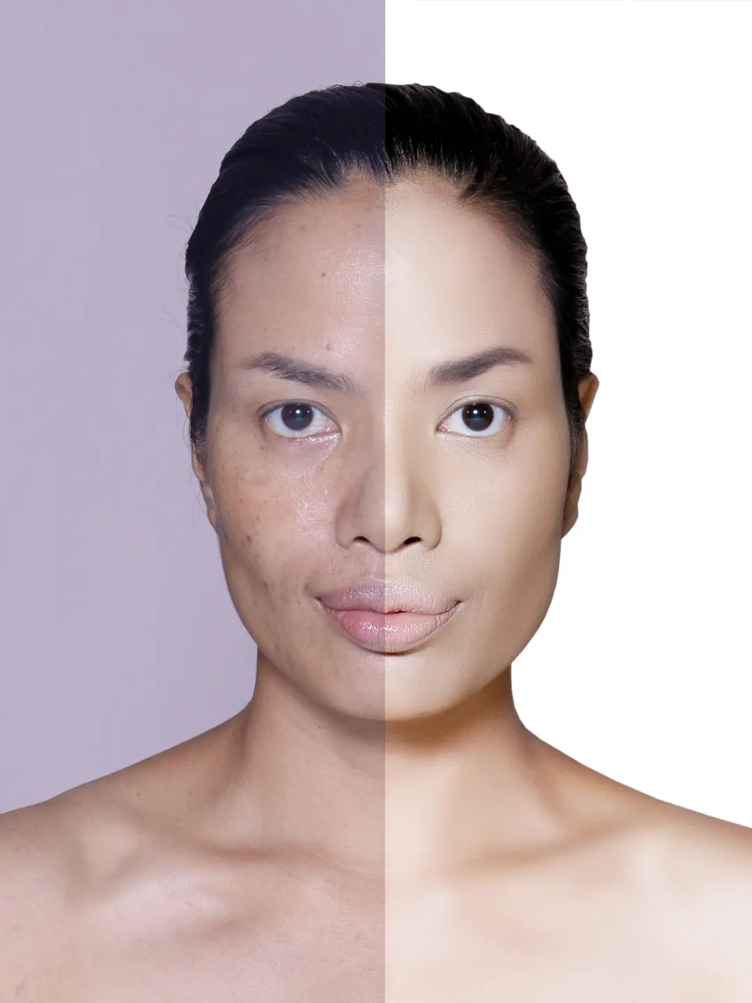 Tratamento facial da mulher: antes e depois.