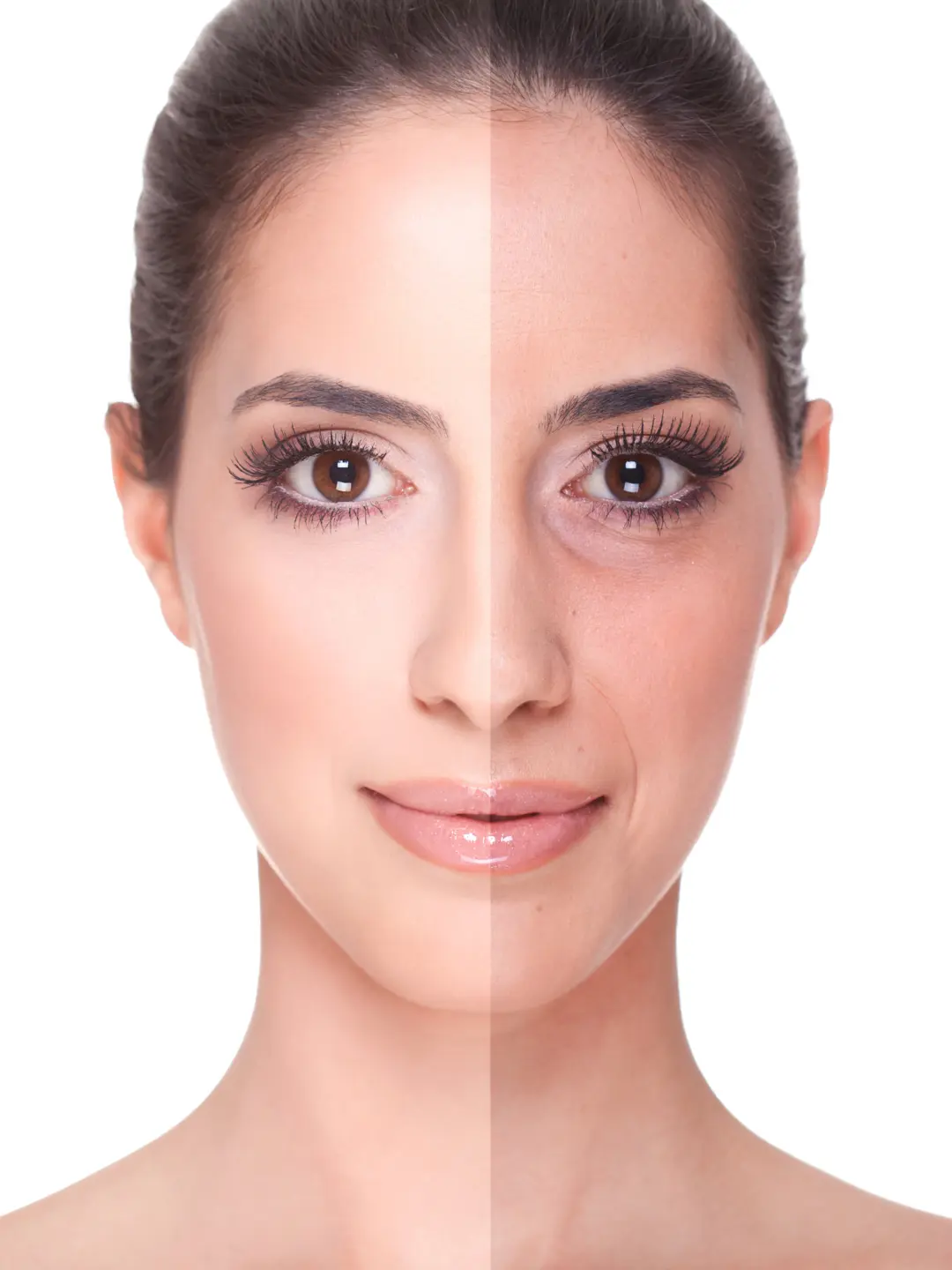 Tratamento facial da mulher: antes e depois.
