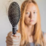 Queda de cabelo na mulher: dicas de tratamento.