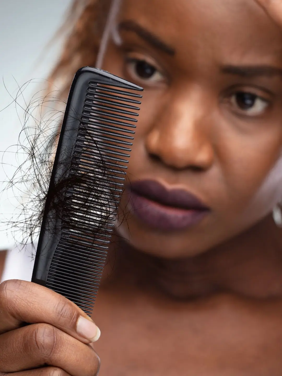 Queda de cabelo na mulher: dicas de tratamento.